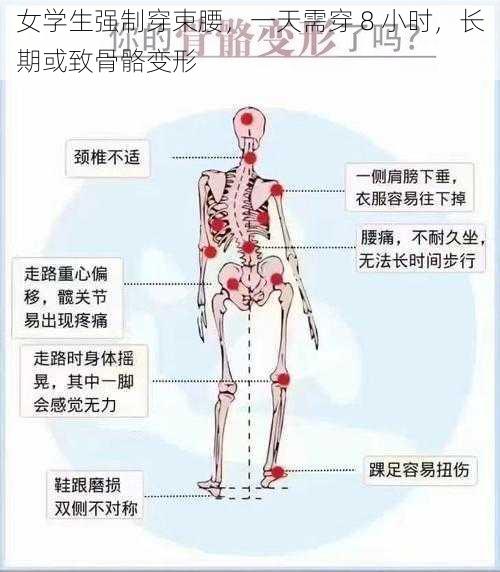 女学生强制穿束腰，一天需穿 8 小时，长期或致骨骼变形